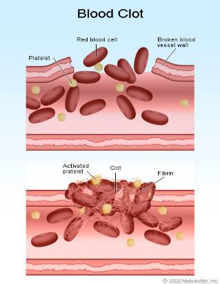 penjelasan mekanisme pembekuan darah